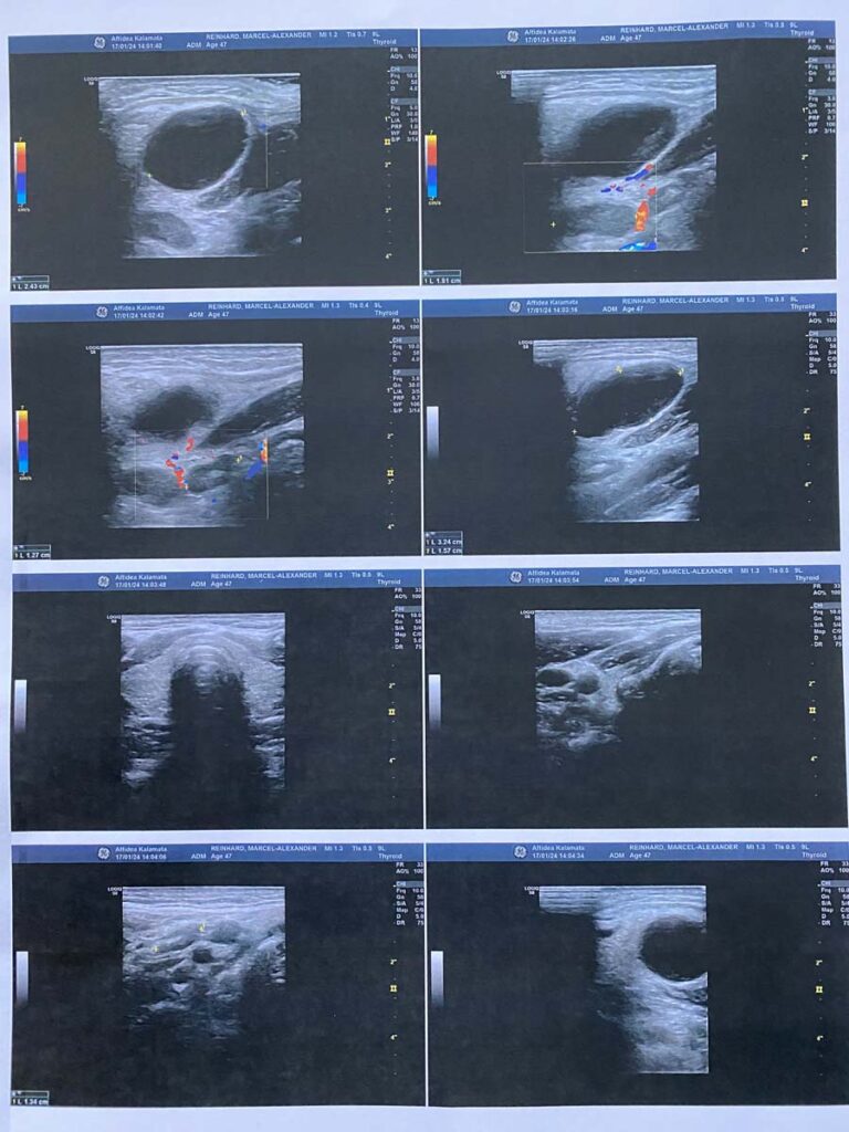 Ultraschallbilder